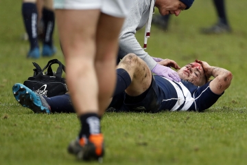 Angus McCance of Oxford head injury during the RCMA Varsity Rugby League game between Cambridge University and Oxford University at the HAC Ground, Moorgate, London on Fri Mar 9, 2018